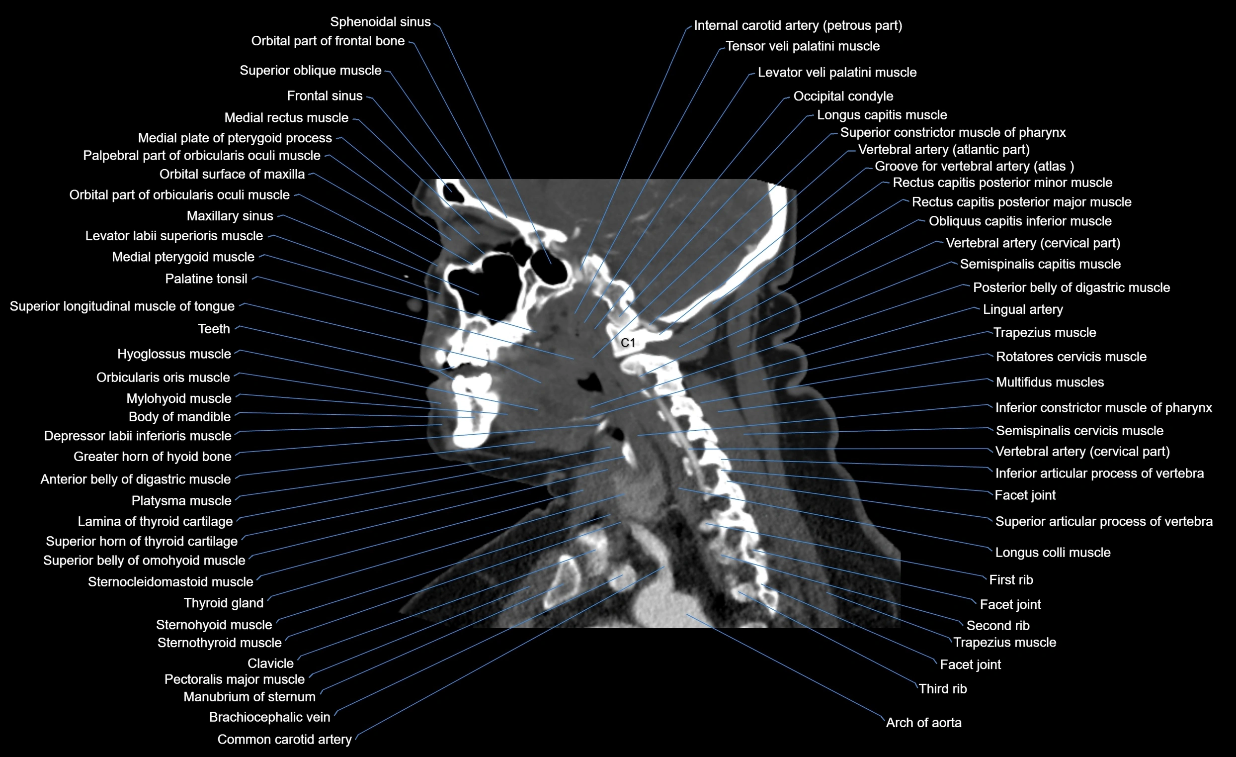 Neck CT sagittal cross sectional anatomy 3D  radiology  image-img-00001-00007.webp